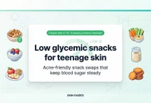 Low glycemic snacks for teenage skin featured image with acne-friendly snack icons and Skin Guides branding