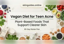 Vegan diet for teen acne featured image with plant-based foods supporting clearer skin, skinguides.online